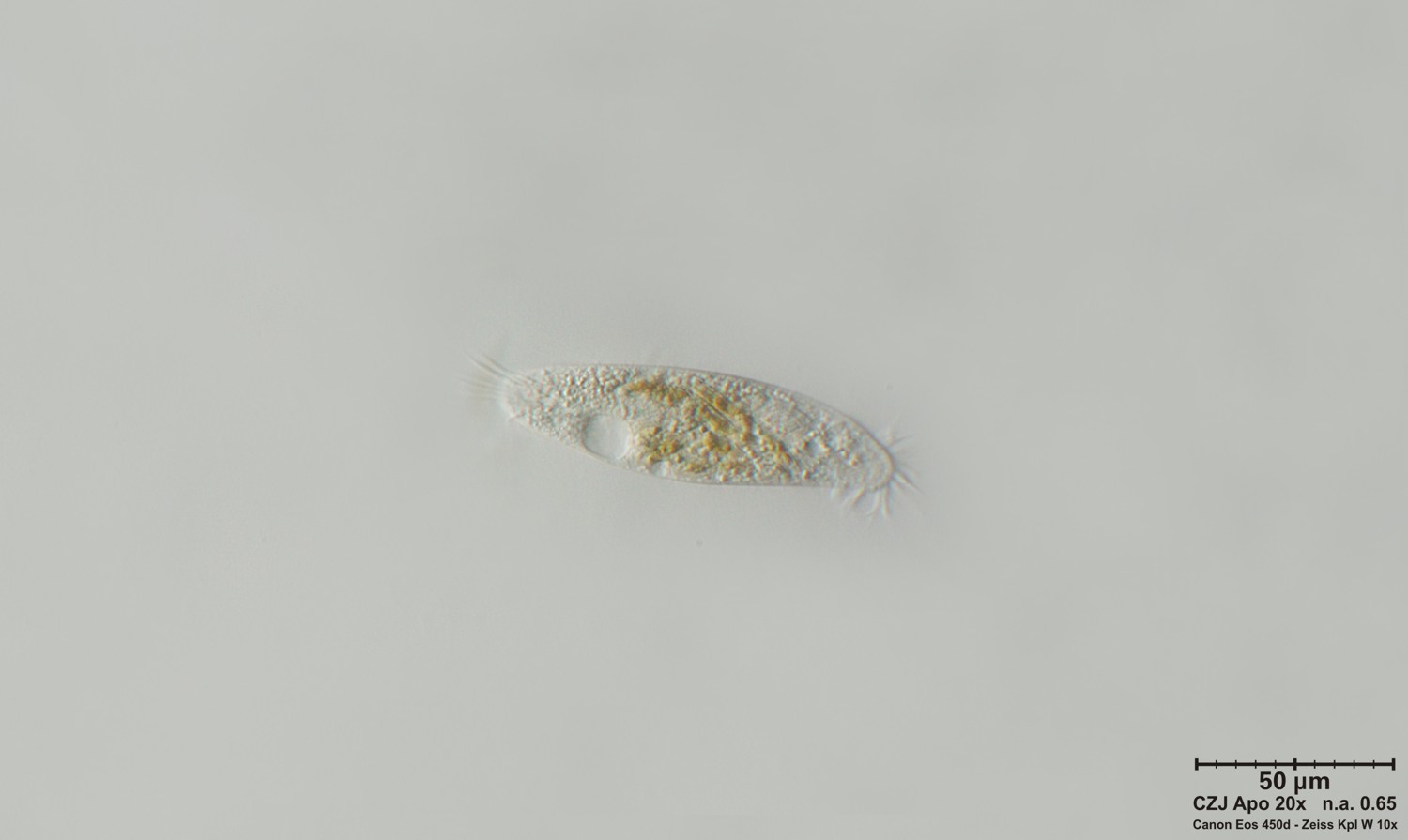 Ciliato non meglio identificato